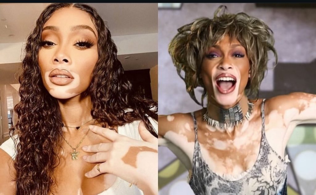 Winnie Harlow Responds To Fans Claims That Her Halloween Costume Mocked Whitney Houston: “People Are More Than Headlines”